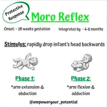 Moro reflex diagram: a protective response with onset about 28 weeks gestation that integrates by roughly 4 to 6 months. The stimulus is rapidly dropping the infant’s head backwards; phase 1 is arm extension and abduction, phase 2 is arm flexion and adduction.