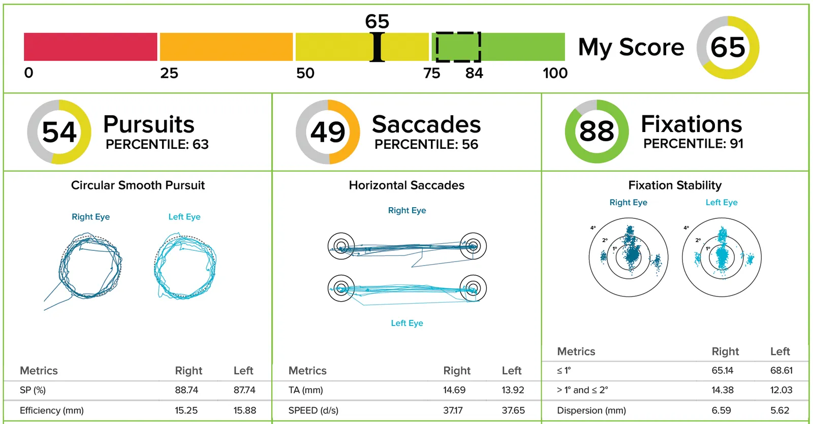 RightEye report showing mild ocular motor dysfunction: an overall score of 65 out of 100, with smoother circular pursuits, tighter saccades and clustered fixation points.