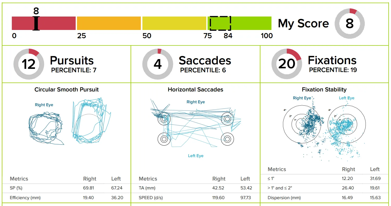 RightEye report showing severe ocular motor dysfunction: an overall score of 8 out of 100, with tangled circular pursuit tracings, scattered horizontal saccades and widely dispersed fixation points.