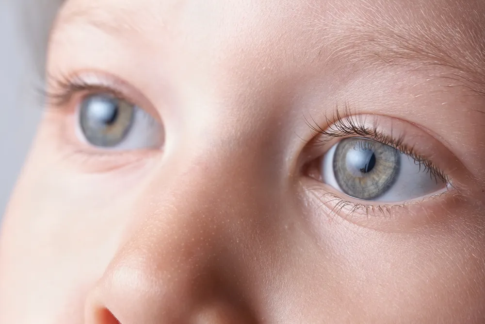 Close-up of a young child's clear, healthy eyes — in cortical visual impairment the eyes work but the brain has difficulty interpreting what they see.