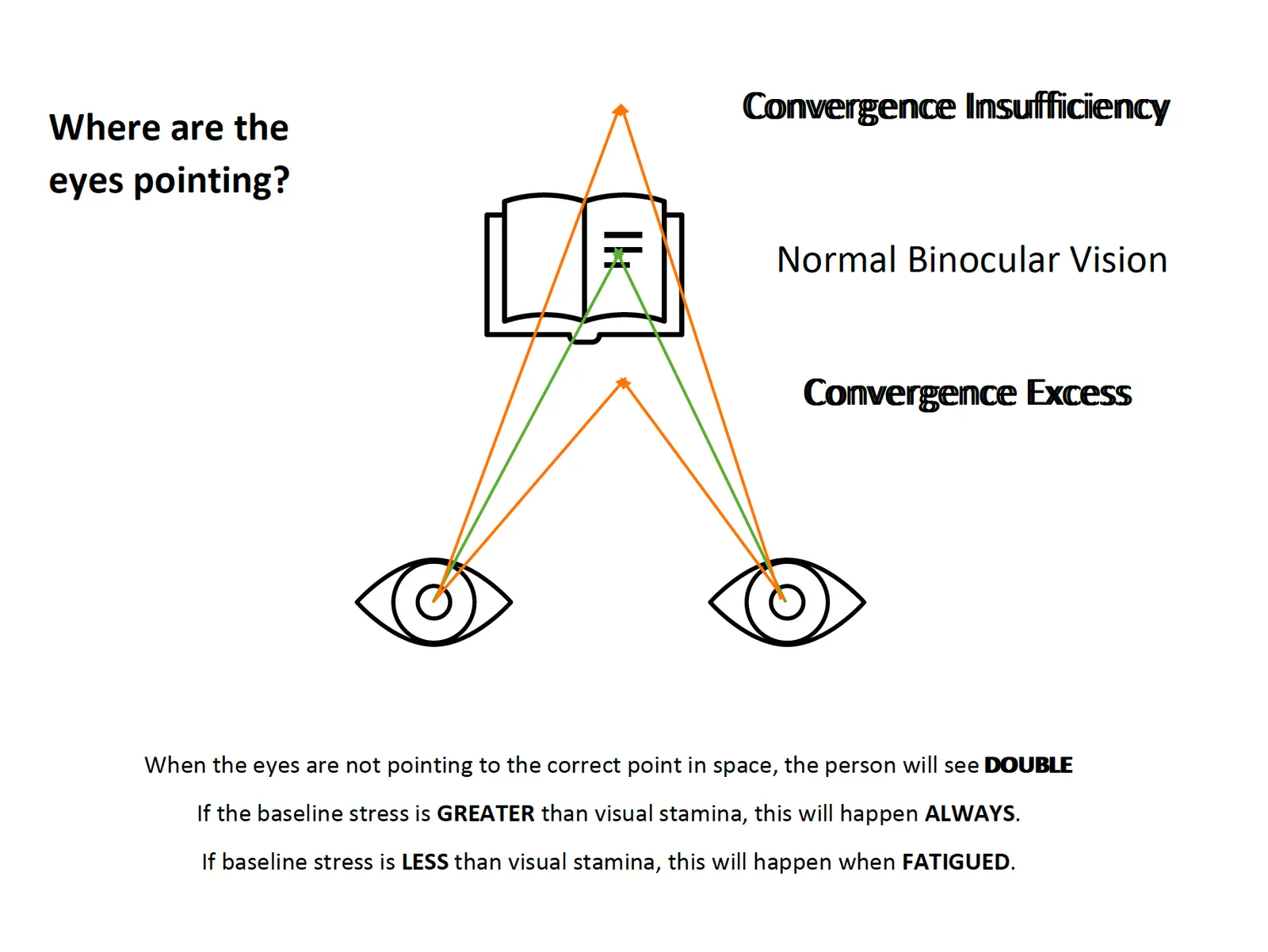 Diagram titled Where are the eyes pointing? Lines of sight from both eyes meet on the open book in normal binocular vision, beyond the book in convergence insufficiency, and in front of the book in convergence excess.