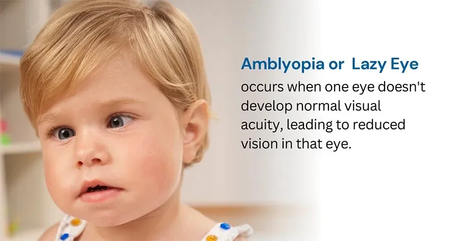 Toddler beside text explaining that amblyopia, or lazy eye, occurs when one eye does not develop normal visual acuity, leading to reduced vision in that eye