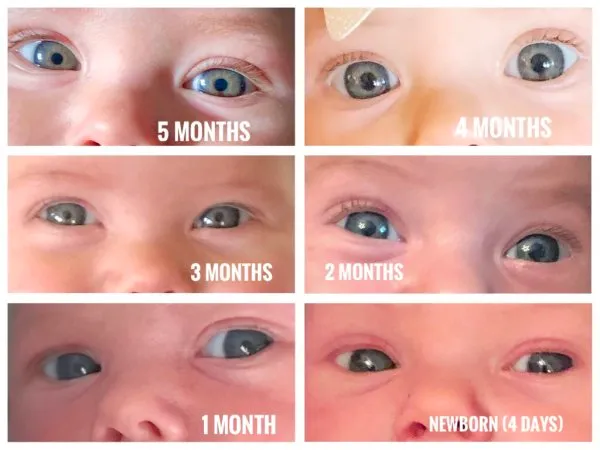 Six photographs of the same baby's eyes labelled newborn (four days), one, two, three, four and five months, showing the irises changing from dark grey-blue to a clearer blue