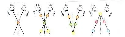Diagram of a Brock string showing the right and left lines of sight crossing in an X at the bead being fixated