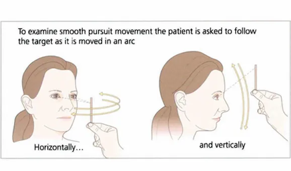 Vision therapist guiding a patient through a smooth pursuit tracking test with a moving target