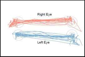 Recording of right-eye and left-eye movements while reading: overlapping horizontal traces in orange and blue show repeated fixations, backward regressions and a return sweep at the end of each line.