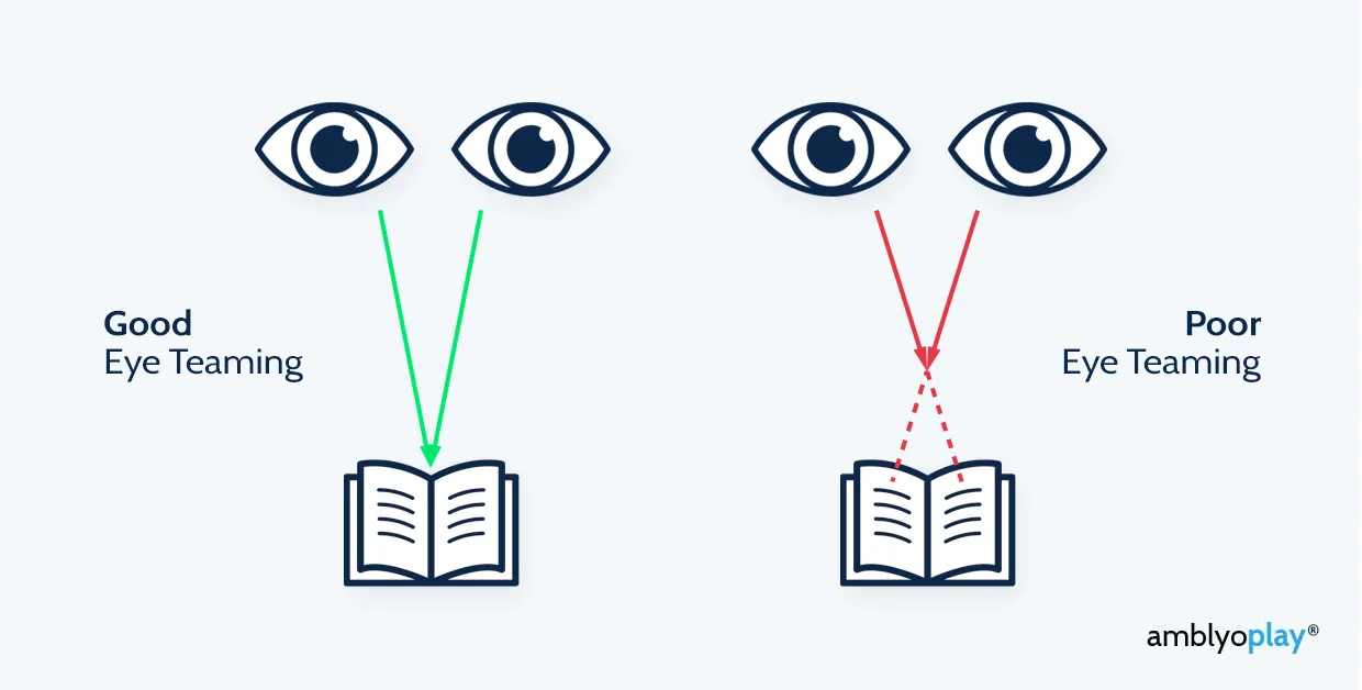 Diagram contrasting good eye teaming, where green arrows from both eyes meet on the book, with poor eye teaming, where red dashed arrows miss the target.