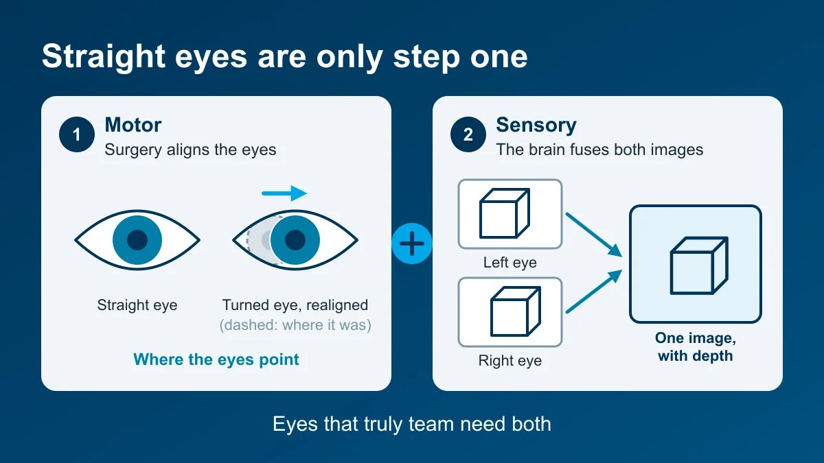 Diagram: surgery realigns a turned eye (motor), and the brain must still fuse the two eyes' views into one image with depth (sensory)